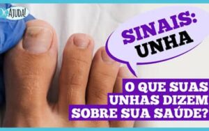 Dr. Ajuda: Unhas fracas podem indicar problemas de saúde