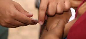 SARAMPO: cobertura na região Norte está próxima da meta de 95% para a primeira dose
